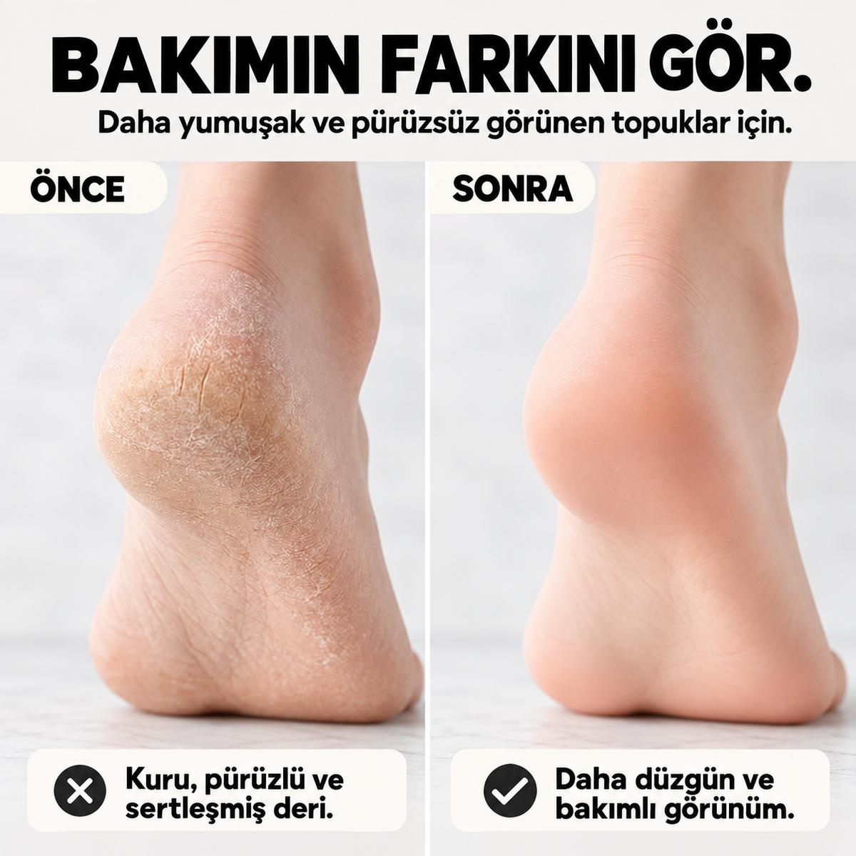 Softivas™ Çift Taraflı Ayak Törpüsü Nasır Ölü Deri Temizleyici